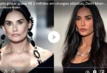 Após gastar quase R$ 2 milhões em cirurgias plásticas, Demi Moore remove preenchimentos do rosto