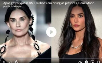 Após gastar quase R$ 2 milhões em cirurgias plásticas, Demi Moore remove preenchimentos do rosto
